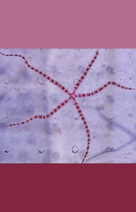 VERY RARE - Candy stripe brittle star
